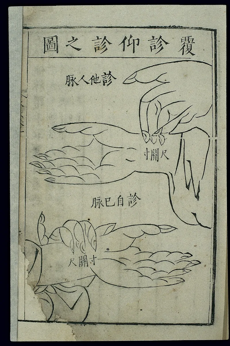 A Ming-era Chinese woodcut showing traditional techniques for feeling the pulse at the wrist